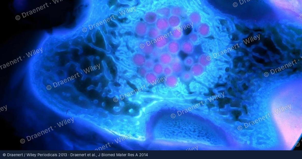 Fluoreszenzmikroskopie aus der Forschung zum Knochenaufbau – Draenert et al., J Biomed Mater Res A 2014 · © Draenert / Wiley Periodicals