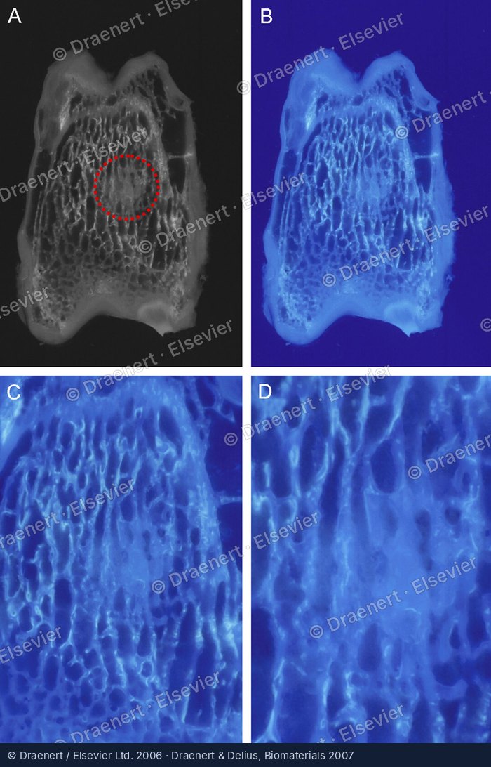 Erste mechanisch stabile Dampfsterilisation biologischer Knochentransplantate – Abbildung aus der Originalpublikation