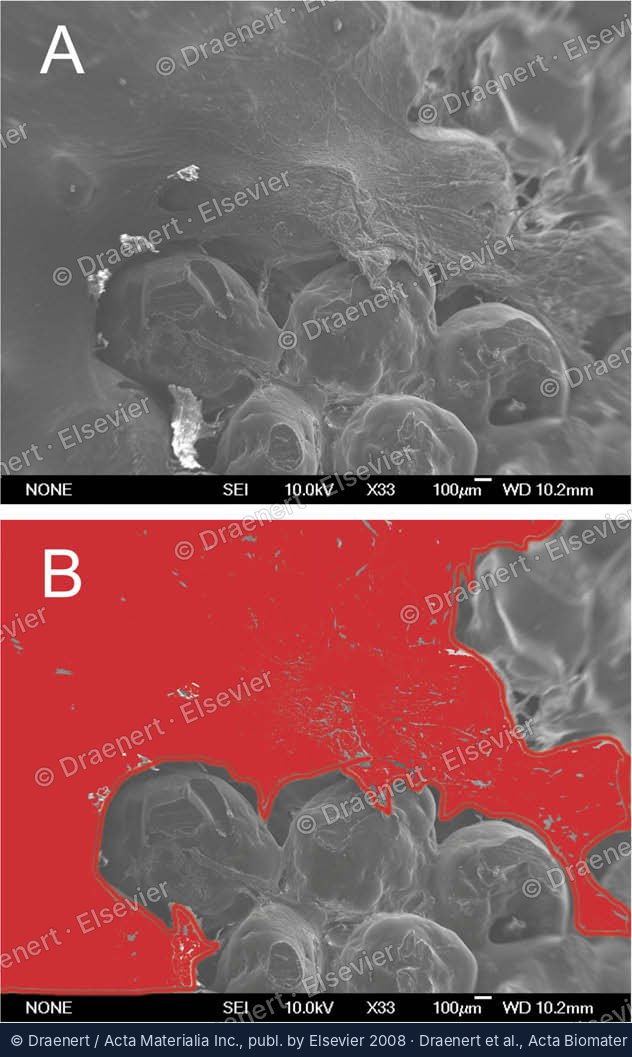Erster Nachweis der biologischen Korrosion von Polyethylen-Biomaterialien – Abbildung aus der Originalpublikation
